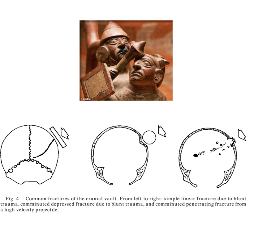 <p>Blunt Force Trauma</p>