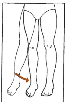 <p>Describe this motion?</p>