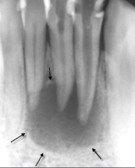 <p>Describe the periphery/borders of the lesion: (4)</p>