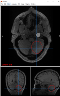 <p>cerebellum</p>