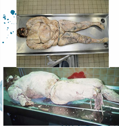 <p>Questions</p><ol><li><p>What postmortem change is characterized by these features?</p></li><li><p>What are the specific physical changes observed in the fat tissue during this process?</p></li></ol><div data-type="horizontalRule"><hr></div><p></p>