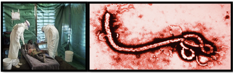 <p><span style="background-color: transparent;"><strong>hat is the prognosis of this disease, </strong></span>Ebola hemorrhagic fever? </p>