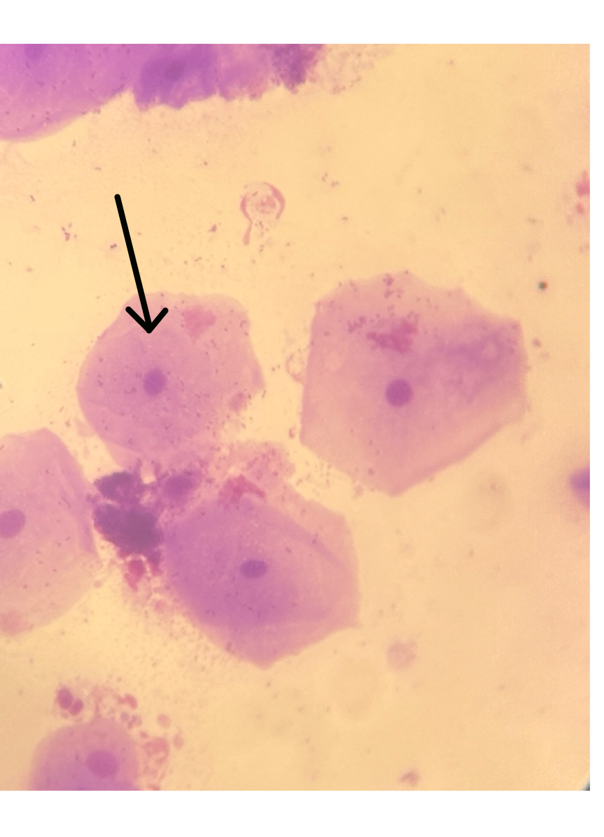 <p>In this Purple stain Human cell what is this</p>