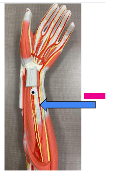 <p>What is the pink arrow?</p>