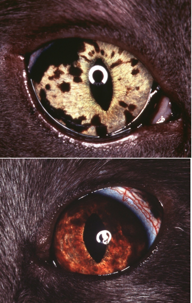 <ul><li><p>gross appearance:</p><ul><li><p>begins as hyperpigmented foci (freckles) on the iris, over months to years coalesce and form masses involving the iris, ciliary body, choroid</p></li></ul></li><li><p>may invade the iridocorneal angle & cause secondary glaucoma</p></li><li><p>distant metastasis may occur infrequently</p><ul><li><p>most commonly to liver, lung, kidney, and spleen</p></li></ul></li></ul><p></p>