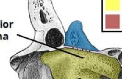 <p>What is this pointing to? What bone is it on?</p>