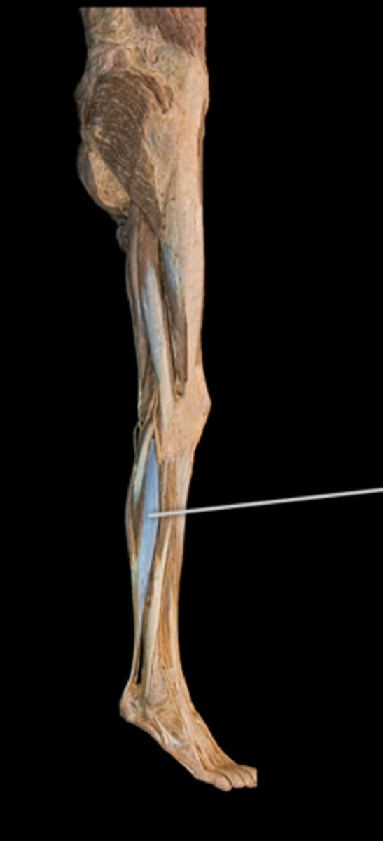 <p>What muscle is this?</p>