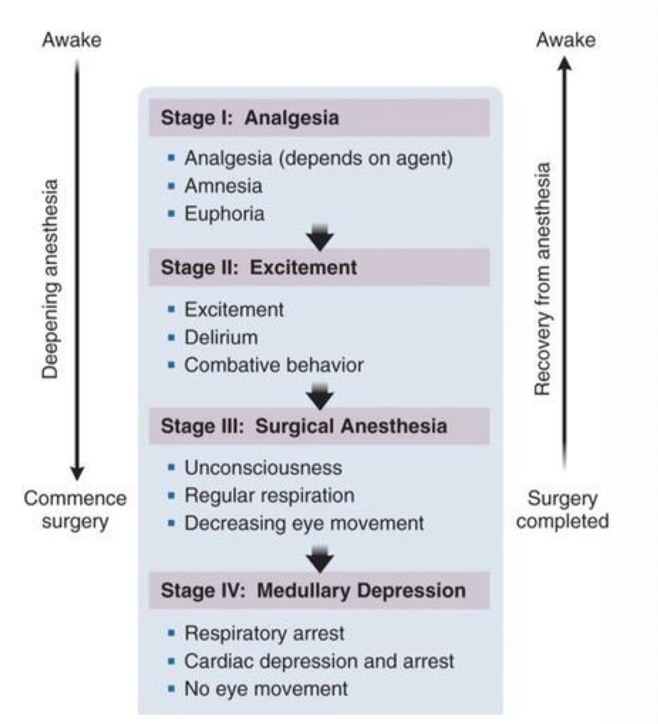 <p>Patient too young, anxious or uncooperative </p><p>Surgeon needs guarantee of completely still patient (complex procedure)</p>
