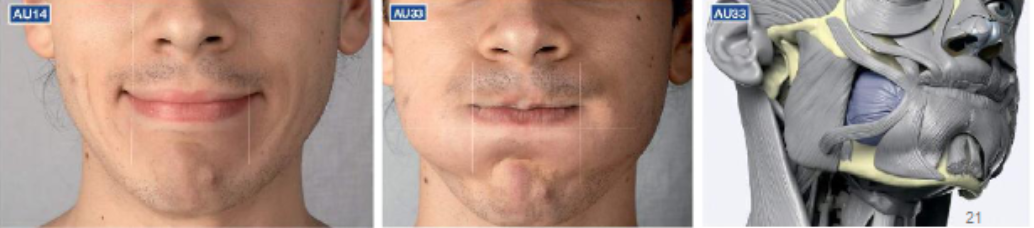 <ul><li><p>like risorius </p></li><li><p>trumpeters muscle</p></li></ul><p></p>