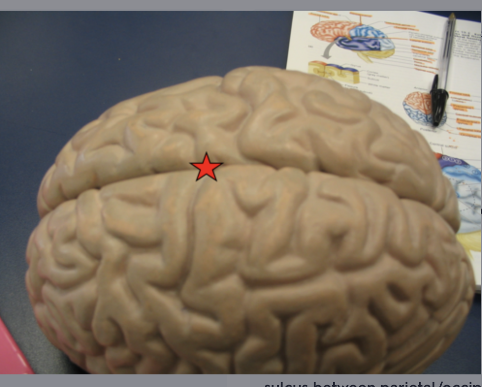 <p>between cerebral hemispheres, location of falx cerebri</p>