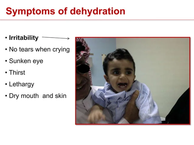 <ol><li><p><span style="color: rgb(232, 123, 123);"><strong>sunken </strong></span><strong>fontanels</strong></p></li><li><p><span style="color: rgb(143, 131, 36);"><strong>lethargic</strong></span></p></li><li><p><span style="color: rgb(76, 131, 26);"><strong>oliguric + concentrated</strong></span> urine</p></li><li><p><span style="color: rgb(32, 176, 68);"><strong>dry </strong>mucous membranes</span></p></li><li><p><span style="color: rgb(59, 127, 173);"><strong>< 6-8</strong> wet diapers/day</span></p></li><li><p><span style="color: rgb(81, 91, 193);"><strong>no tears</strong> when crying</span></p></li><li><p><span style="color: rgb(179, 80, 224);">skin turgor > 3 sec</span></p></li><li><p><span style="color: rgb(216, 48, 170);">pale</span></p></li><li><p><span style="color: rgb(43, 84, 190);">hypotensive</span></p></li></ol><p></p>