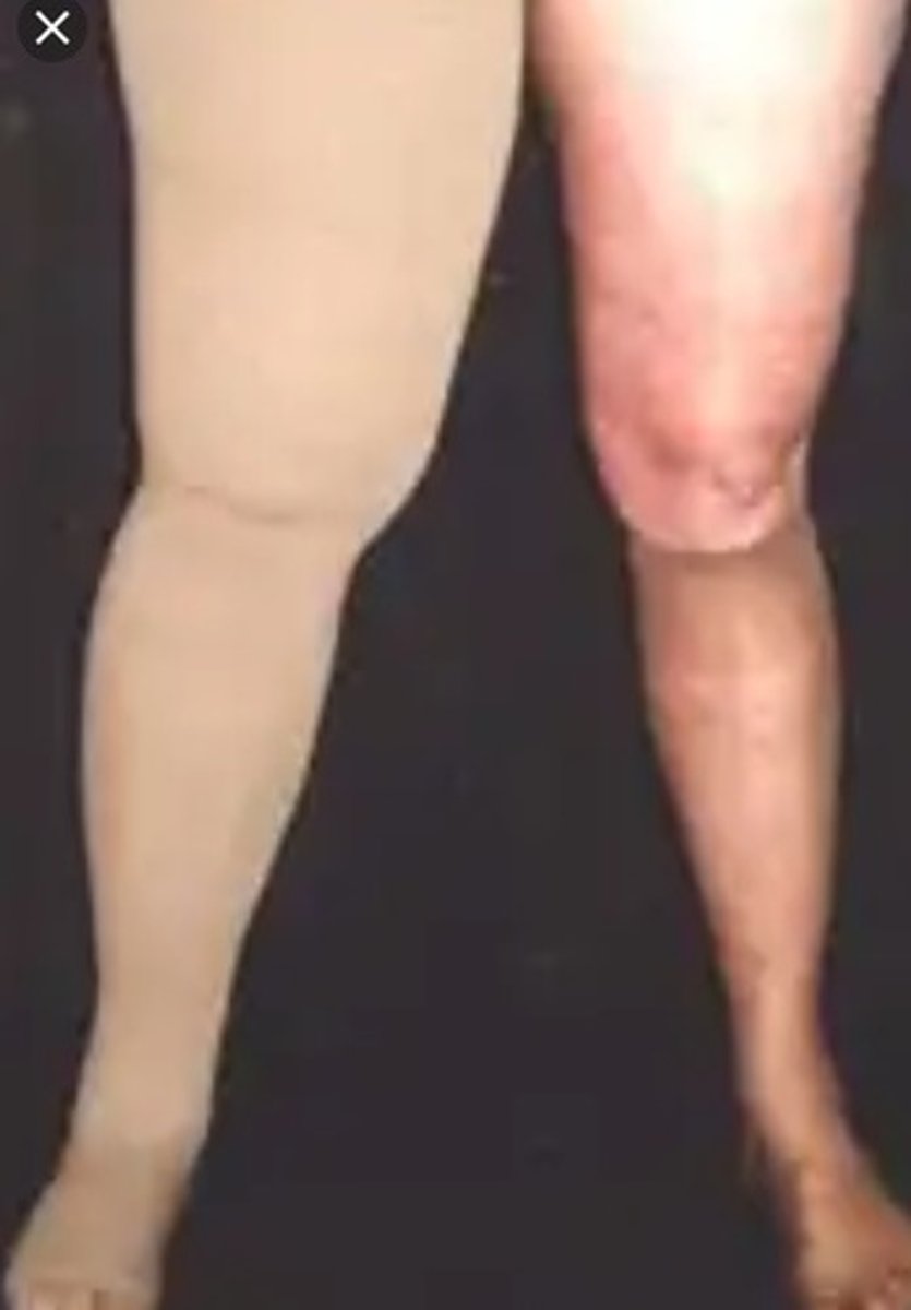 <p>half/full pant - more consistent suspension/compression (obese pt)</p>