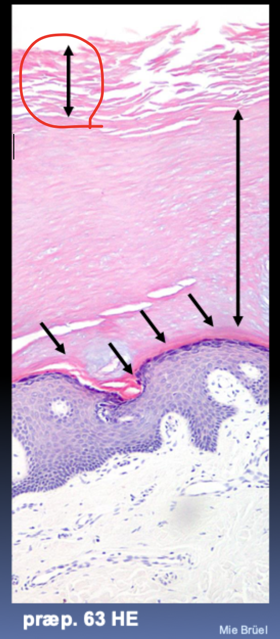 <p>Yderste del af stratum corneum, hvor døde hornceller <strong>afskalles</strong>.</p>