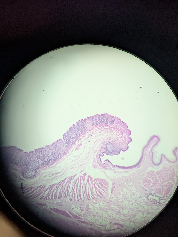 <p>Where in the body is this</p>