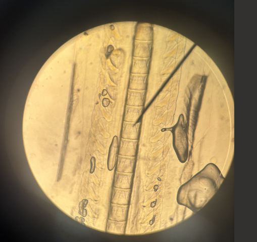 <p>What Phylum is this and what is it called?</p>