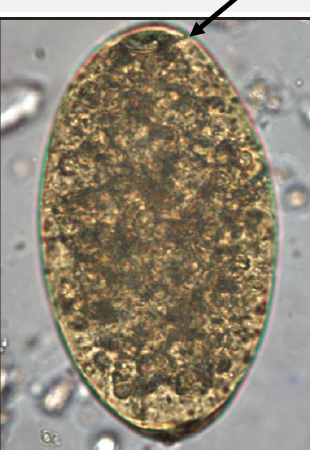 <p>Practice Question: What is the name of the structure indicated by the arrow?</p>