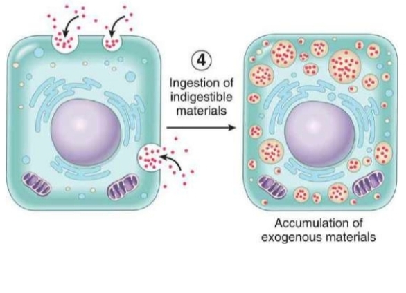 <p>normal cell surrounded by indigestible materials. INGESTION → exogenous material accumulates w/in call</p>