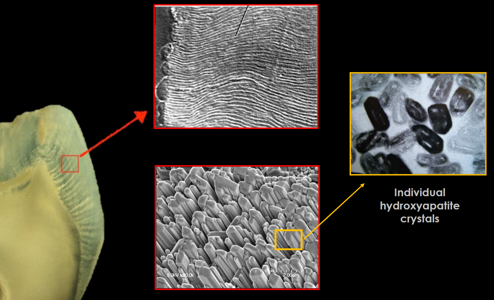 <p>An enamel rod is the basic unit of tooth enamel. It is a tightly packed, highly organized mass of</p><p>hydroxyapatite crystals, which are hexagonal in shape and provide rigidity and strengthen the enamel</p>