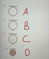 <p>B</p>