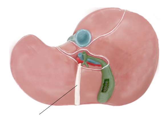 <p><span>Name the structure</span></p>