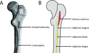 <p>Linea Aspera</p>