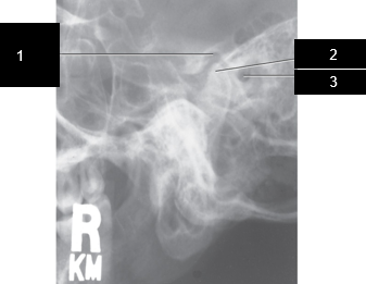 <p>label 3</p>