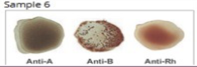 <p>What blood type is this?</p>