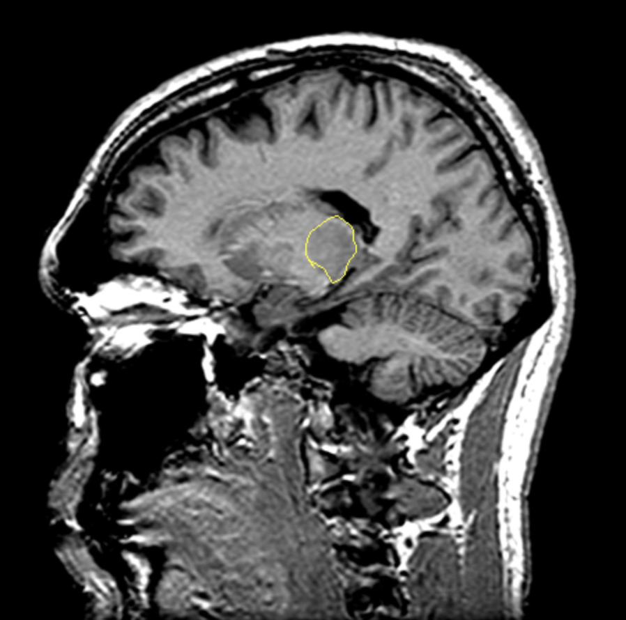 <p>What is the area highlighted called?</p>