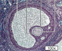 <p>What structure of follicle development is this?</p>