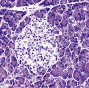 <p>pancreas</p>