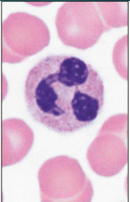 <p>multilobed </p><p>phagocytic cells that engulf pathogens and debris</p><p>especially responsive to bacterial infection </p><p>1st ones to the scene</p>