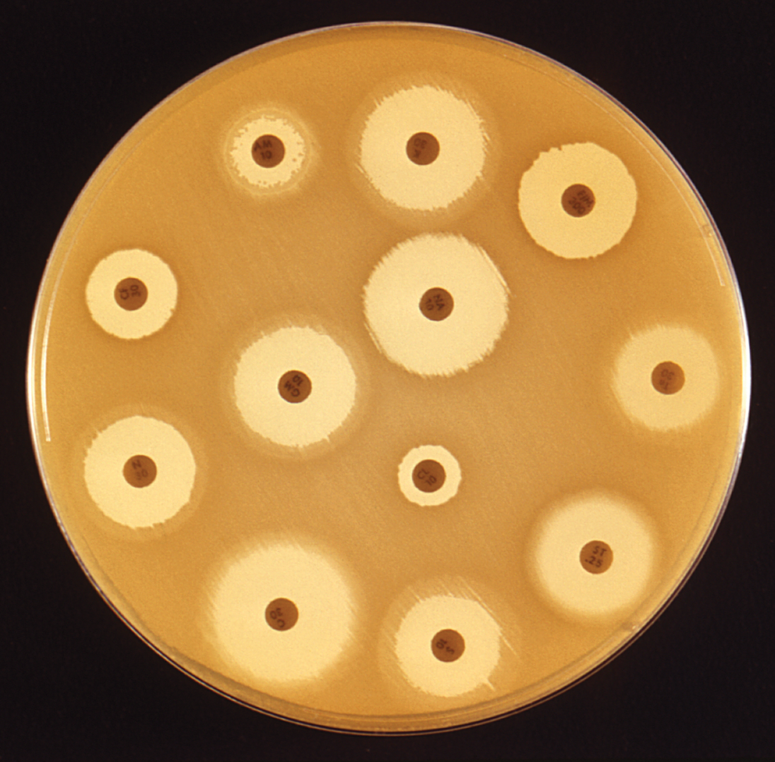 <p><mark data-color="yellow" style="background-color: yellow; color: inherit;">Susceptibility testing, also known as </mark><strong><mark data-color="yellow" style="background-color: yellow; color: inherit;">Kirby-Baur disk diffusion</mark></strong></p><p><u>Method</u>: spread bacteria onto plate and plate antibiotic impregnated disks on plate and incubate it</p><p>» determines susceptibility of bacterial strain to different antibiotics</p><p><mark data-color="yellow" style="background-color: yellow; color: inherit;">» the greater the susceptibility, the greater the zone of inhibition</mark></p><p>» <strong><mark data-color="purple" style="background-color: purple; color: inherit;">zone of inhibition</mark></strong>: <mark data-color="yellow" style="background-color: yellow; color: inherit;">area of no growth around disc</mark></p>