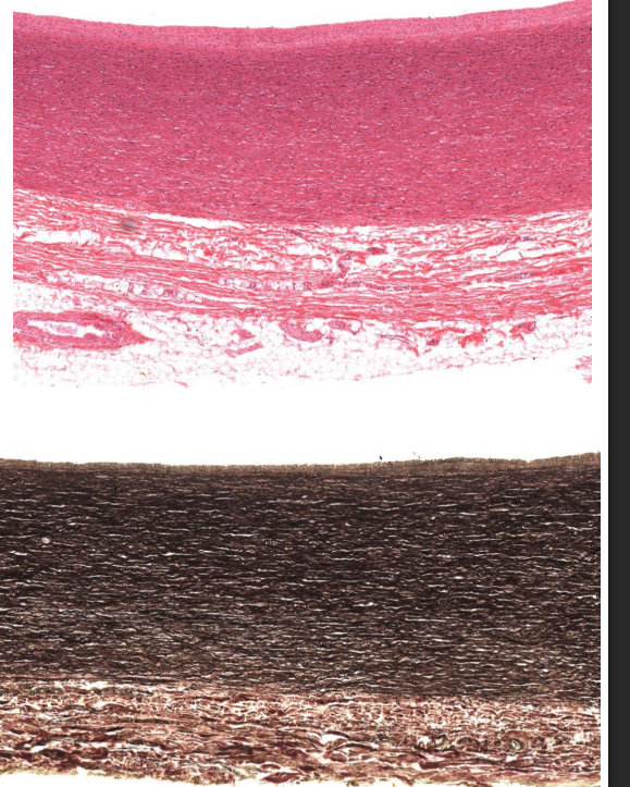 <p>Identify these two vessels?</p>