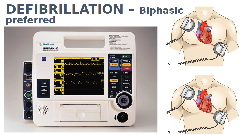 <p>Biphasic</p>