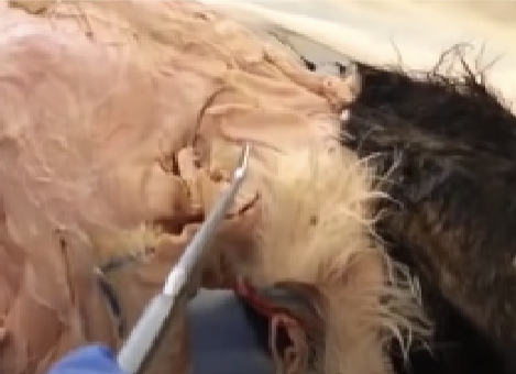<p>Arises from the back of the skull and middorsal line of the neck and inserts on the clavicle. Its action is to extend the humerus in a forward direction.</p>