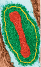 <p><span>Name the type of capsid that certain viruses have based on the structure:</span></p>