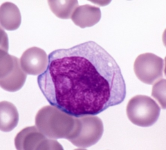 <p>Auer rods are commonly seen in what cell?</p>