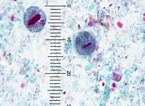 mature have four nuclei, very small