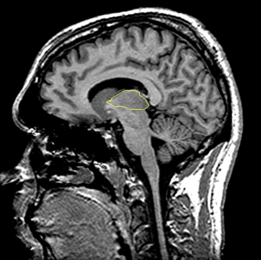 <p>What is the area highlighted called?</p>
