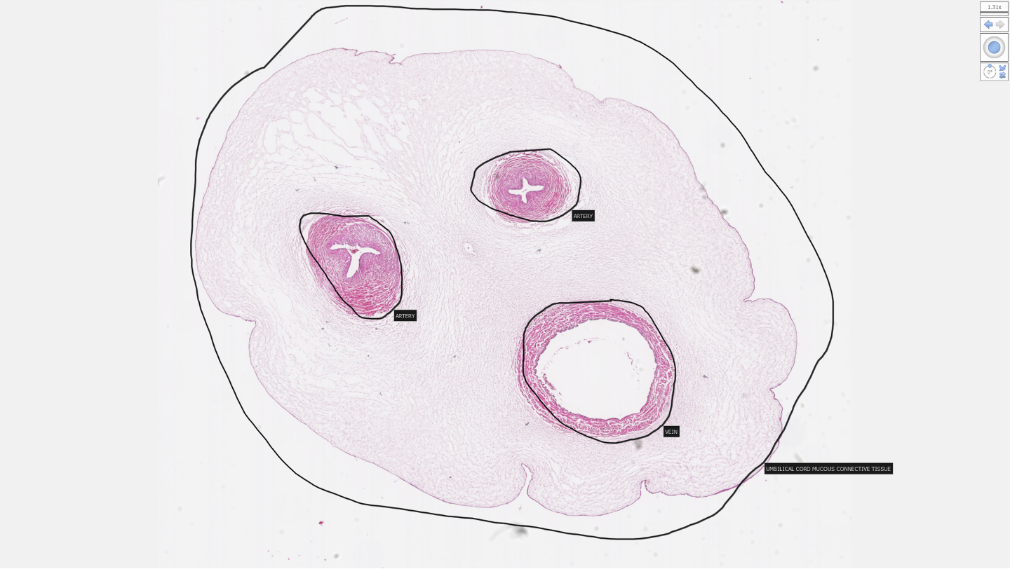 <p>mucous CT</p>