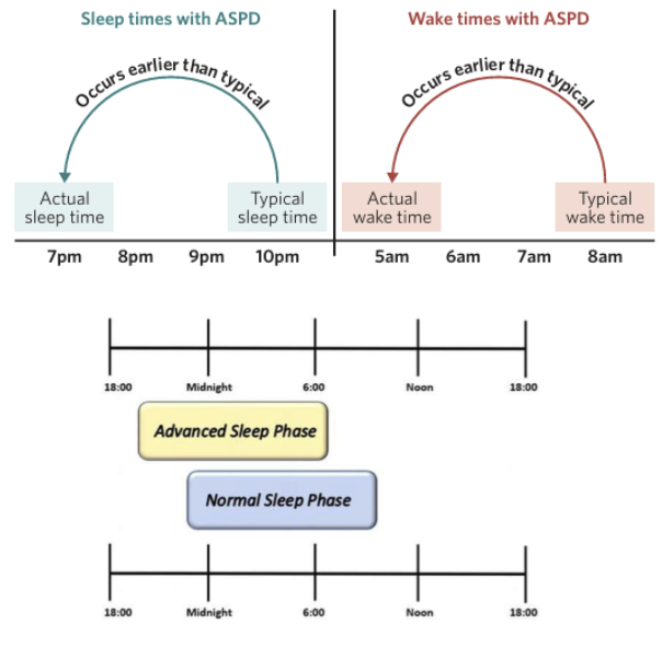 <p><span style="background-color: inherit; line-height: 20.7px; color: windowtext;"><strong>Advanced sleep phase disorder (ASPD)</strong> is a type of circadian rhythm sleep disorder characterised by an earlier (advanced) sleep onset time and an earlier (advanced) awakening time, compared</span><span style="line-height: 20.7px; color: windowtext;"> </span></p><p class="Paragraph SCXO94653249 BCX0" style="text-align: left;"><span style="background-color: inherit; line-height: 20.7px; color: windowtext;">with what is desired</span><span style="line-height: 20.7px; color: windowtext;">/accepted/conventional</span></p><ul><li><p class="Paragraph SCXO94653249 BCX0" style="text-align: left;"><span style="background-color: inherit; line-height: 20.7px; color: windowtext;">In this way, the sleep-wake cycle is advanced</span><span style="line-height: 20.7px; color: windowtext;"> - where melatonin secretion occurs earlier</span></p></li><li><p class="Paragraph SCXO94653249 BCX0" style="text-align: left;"><span style="background-color: inherit; line-height: 20.7px; color: windowtext;">Sleep is usually 2 or more hours later than needed/acceptable</span><span style="line-height: 20.7px; color: windowtext;"> </span></p></li><li><p class="Paragraph SCXO94653249 BCX0" style="text-align: left;"><span style="background-color: inherit; line-height: 20.7px; color: windowtext;">e.g. if an individual typically sleeps at 10pm and wakes at 8am, with ASPD they may sleep at 7pm and wake at 5am</span><span style="line-height: 20.7px; color: windowtext;"> </span></p></li></ul><p></p>