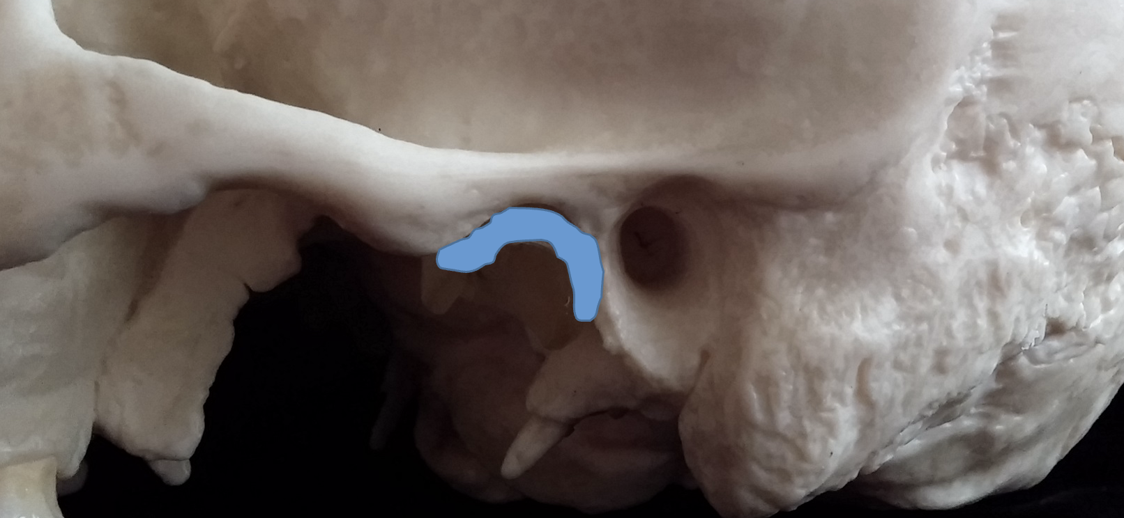 <p>What is the blue region highlighted on the temporal bone?</p>