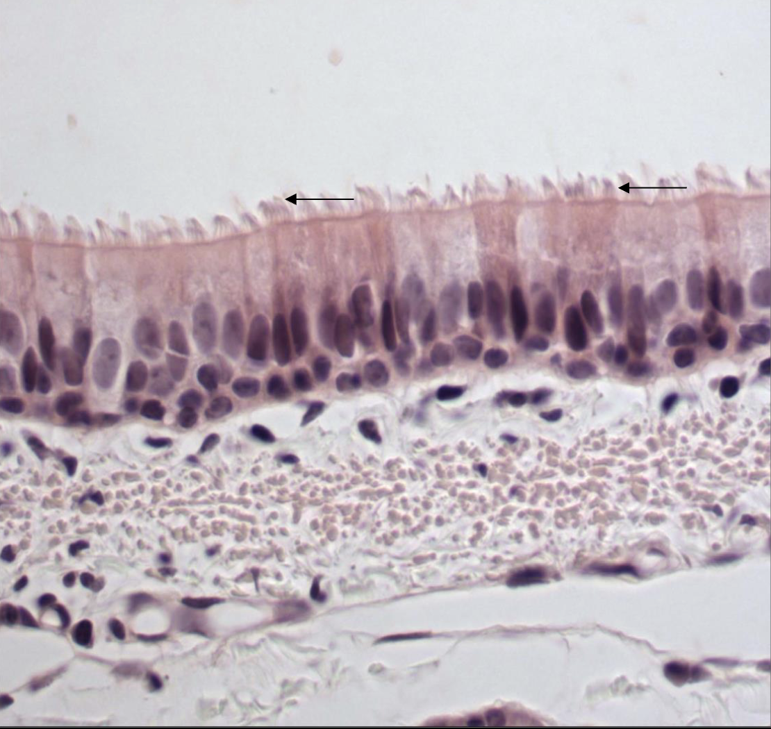 <p>Identify </p><ul><li><p>what are the black arrows pointing at? </p></li></ul><p></p>