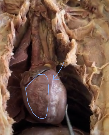 <p>right and left ventricles</p>