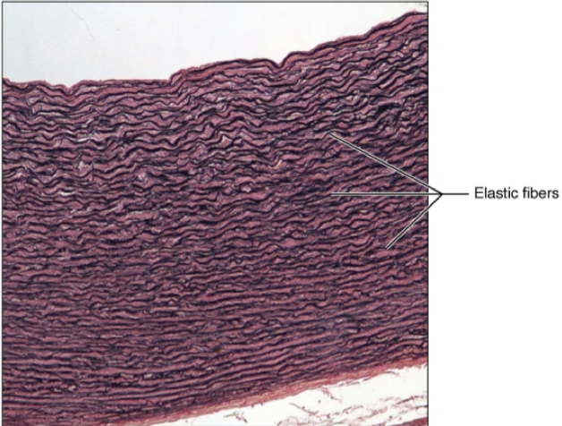 <ul><li><p>location: Walls of large arteries, within certain ligaments associated with the vertebral column. Within walls of bronchial tubes. </p></li><li><p>function: allows recoil for tissue after stretching, maintains flow of blood through arteries, recoil of lungs after respiration. </p></li></ul><p></p>