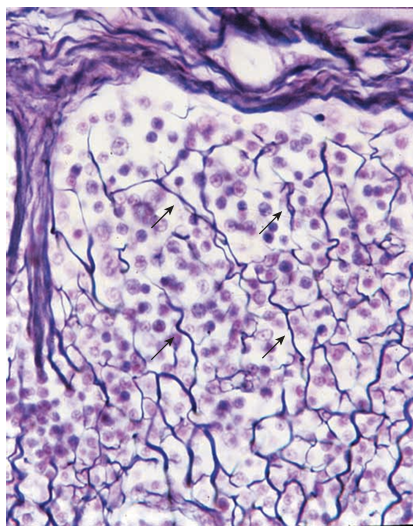 <p>Identify</p>