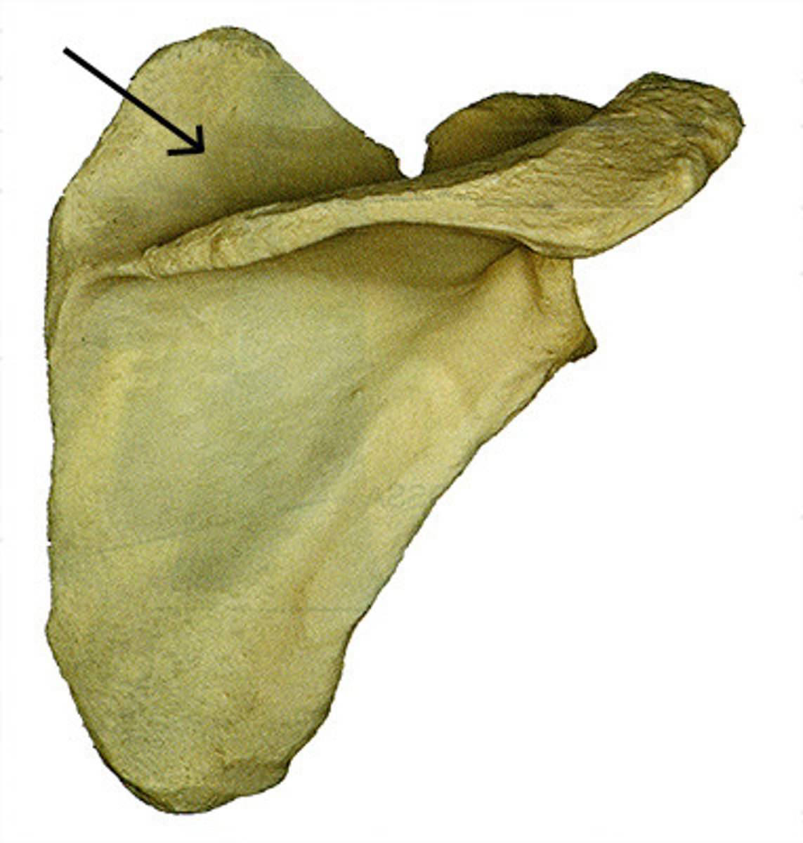 <p>posterior concavity superior to the scapular spine</p>