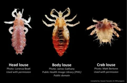 <p>Head Lice: Found on the hair of head, may also be present in the beard, eyelashes, etc.</p><p>Body Lice: Found on the clothing, lay eggs on or near seams of clothing, move to skin to feed</p><p>Public Lice: Found on the hair around the genitals</p>