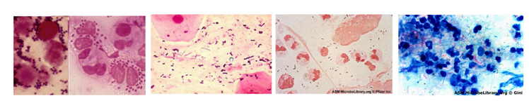 <p>Tinción de Gram: sirve para detectar bacterias y para clasificarlas en Gram negativas o Gram positivas. Nos ayuda a ver en el esputo si tiene valor o no</p><p>Tinción de Ziehl-Neelsen: para detectar Mycobacterium</p>