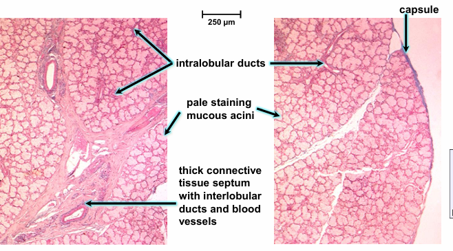 <p>mucous</p>